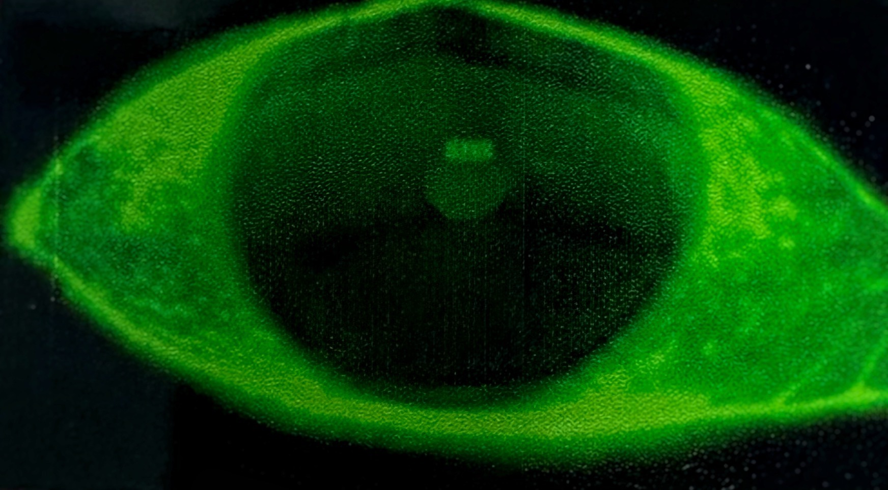 Fluorescein used to stain a dry eye.